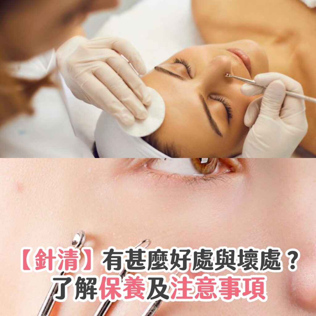 【針清】有什麼好處與壞處？了解保養及注意事項