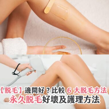 【脫毛】邊間好？比較 6 大脫毛方法、永久脫毛好壞及護理方法