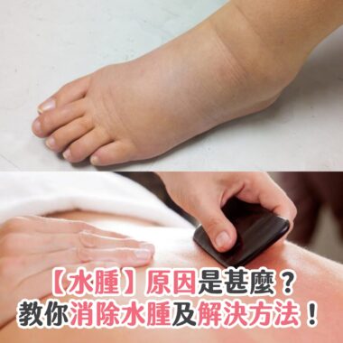 【水腫】原因是甚麼？教你消除水腫及解決方法！