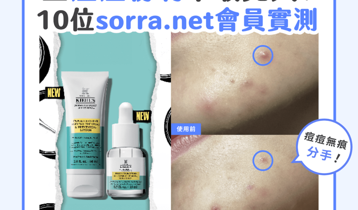 【#sorra產品搜查隊】生痘痘粉刺不敢見人？10位sorra.net會員實測！