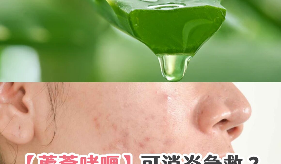 【蘆薈啫喱】可消炎急救？4大蘆薈凝膠推介、功效及用法
