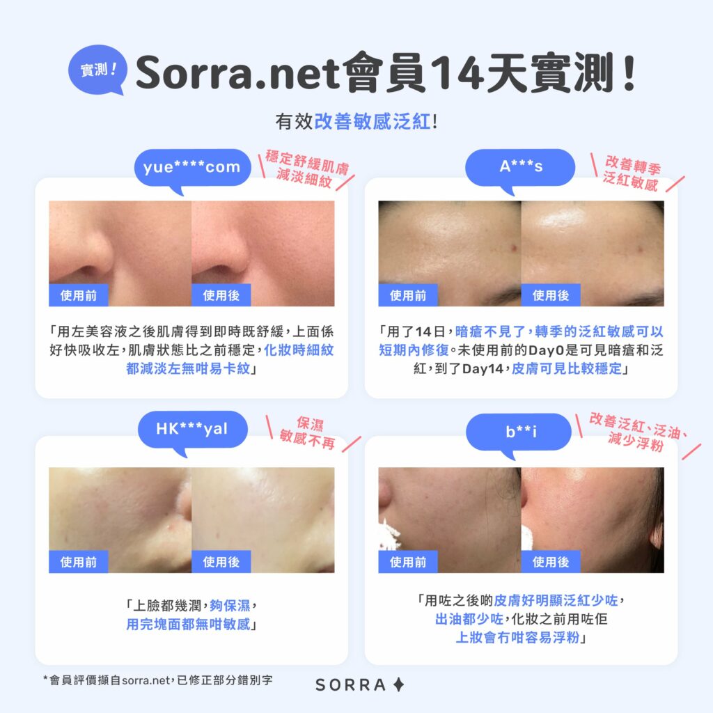 sorra.net會員14天實測！有效改善敏感泛紅!