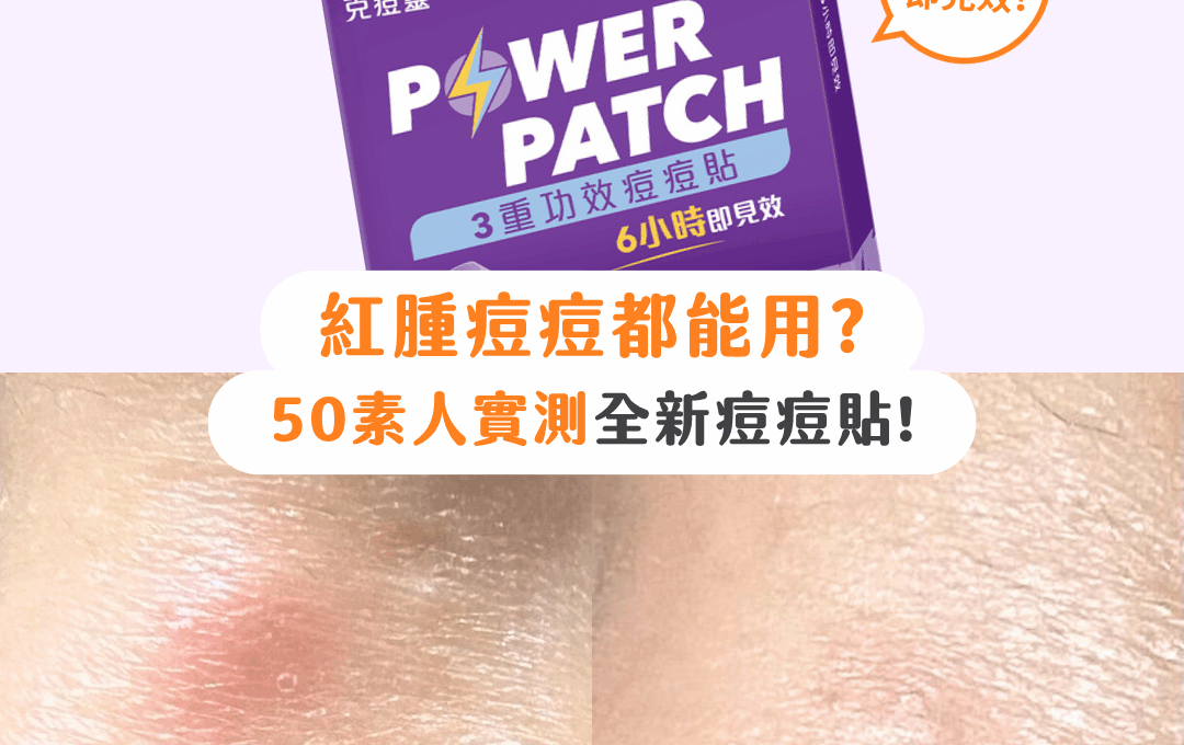 【#sorra產品搜查隊】紅腫痘痘都能用？50素人實測Benzac全新痘痘貼！
